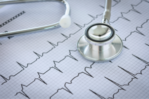 MEDICINE FACULTY RESEARCH gein Bases Moleculares en cardiologia y Neurologia 470 300x200 MEDICINE FACULTY RESEARCH Estudiar en Universidad Privada Madrid